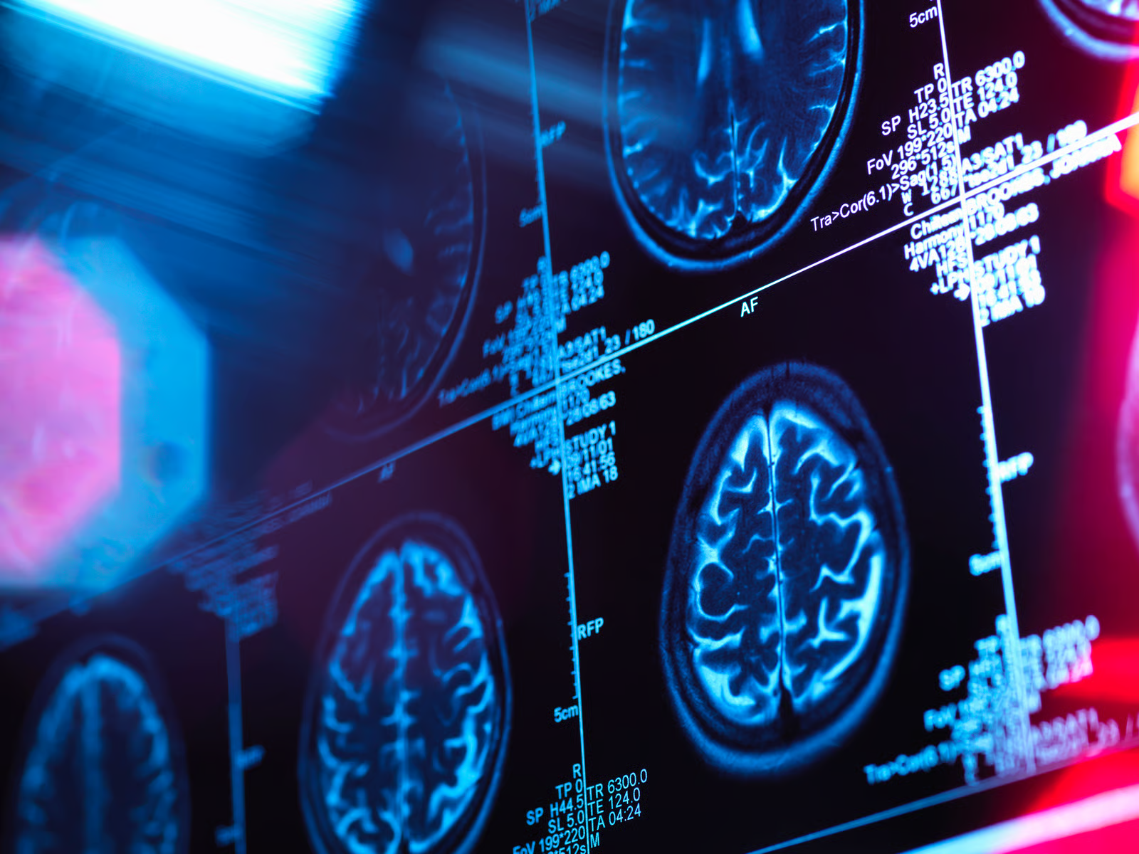 Futuristic brain MRI background