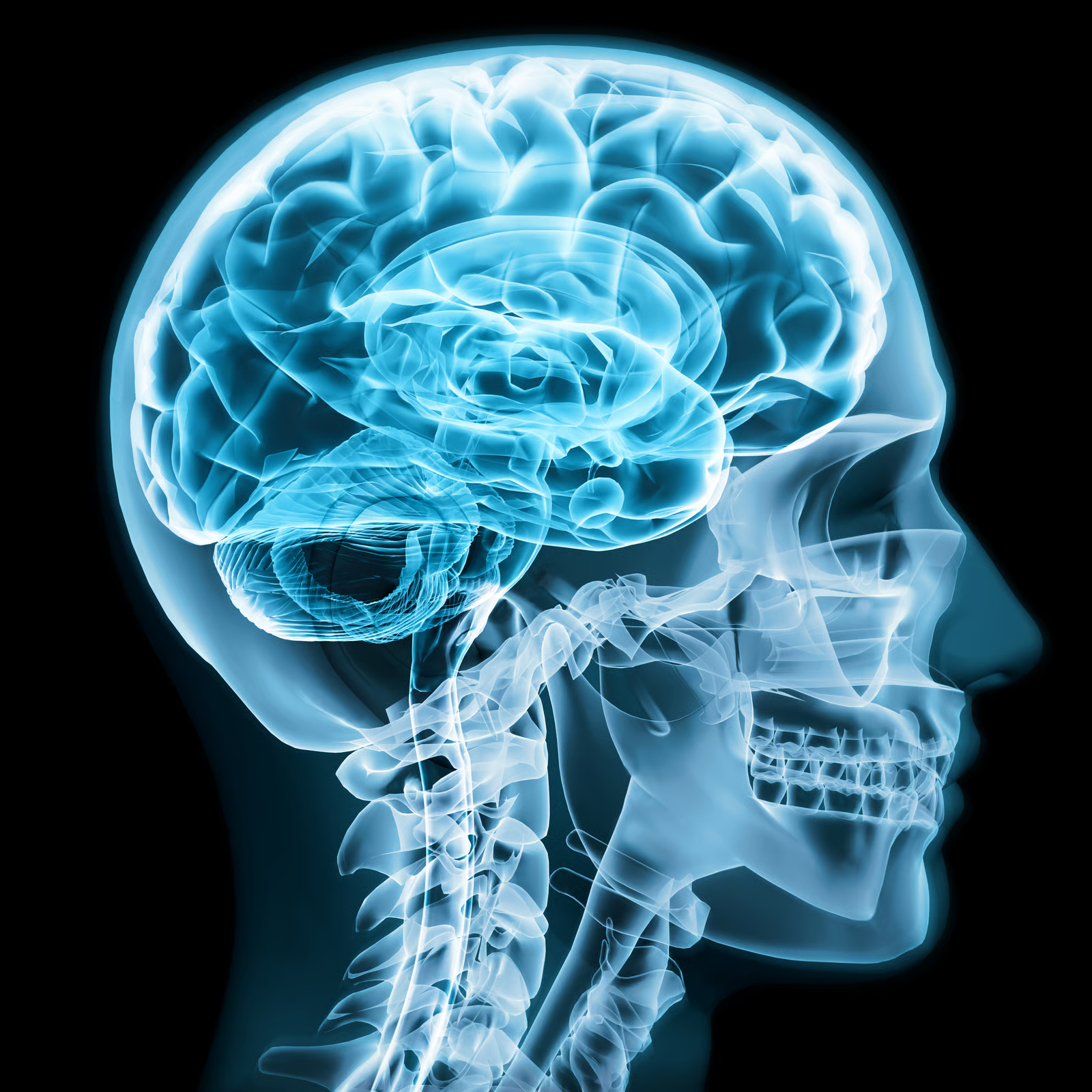 Medical AI brain MRI display