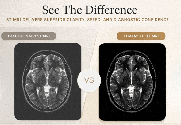 MRI Comparison